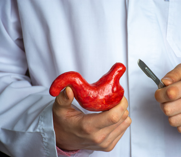 Pre-operative bariatric surgery preparation